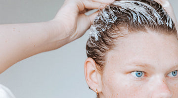How To Treat Your Dry, Flaky Scalp